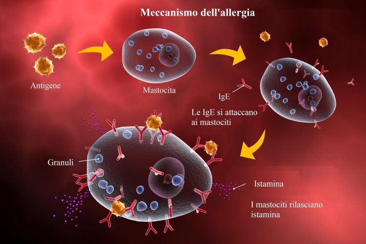 reazione-allergica-2-750x500