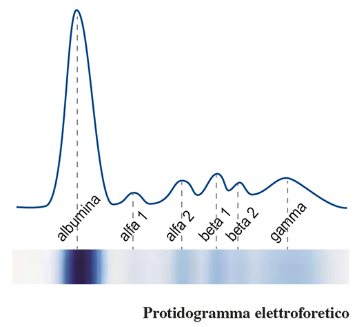Protidogramma: valido strumento diagnostico non&nbsp;invasivo.